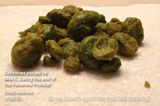 Pulverized Gallstones Max C
