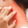 Allergies Are the Common Liver Disease Symptom