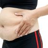Fatty Liver Disease Symptoms: Cellulite