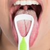 White Tongue Is One of the Fatty Liver Symptoms