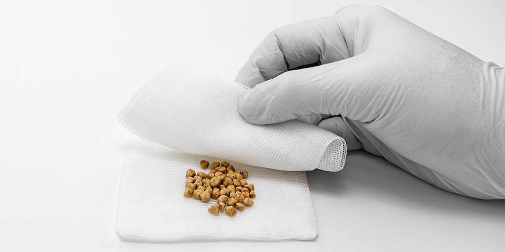 Understanding Gallstones To Achieve Gallbladder Pain Relieftw