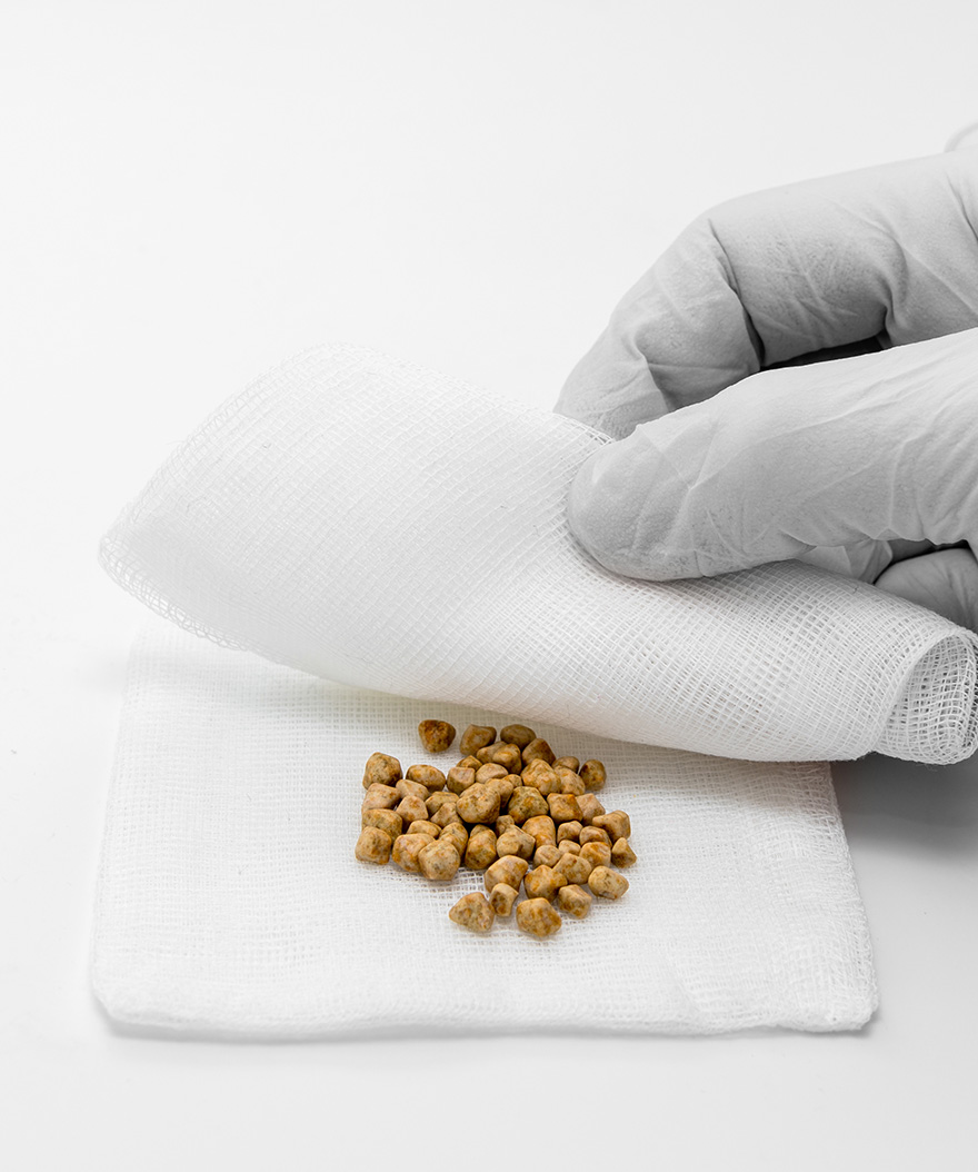 Understanding Gallstones To Achieve Gallbladder Pain Relief?